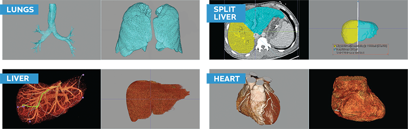 3D volumetric rendering of organs
