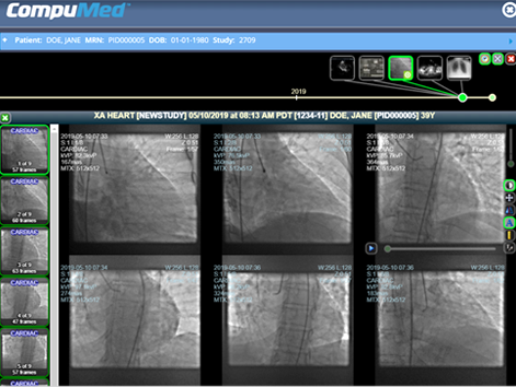 teleradiology portal XA heart study