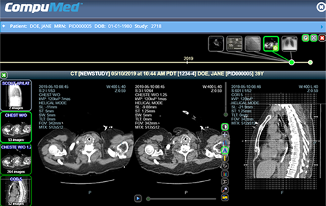 teleradiology portal CT study
