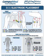 ECG Electrode Placement Poster - CompuMed, Inc