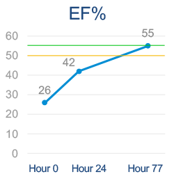 Serial echo shows EF improvement of donor heart