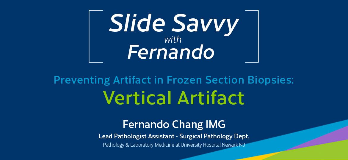 Slide-Savvy-prevent-vertical-artifact