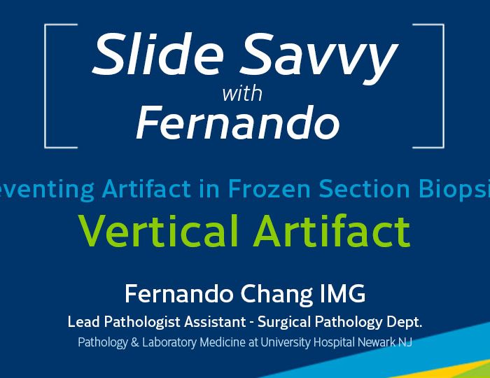 Slide-Savvy-prevent-vertical-artifact