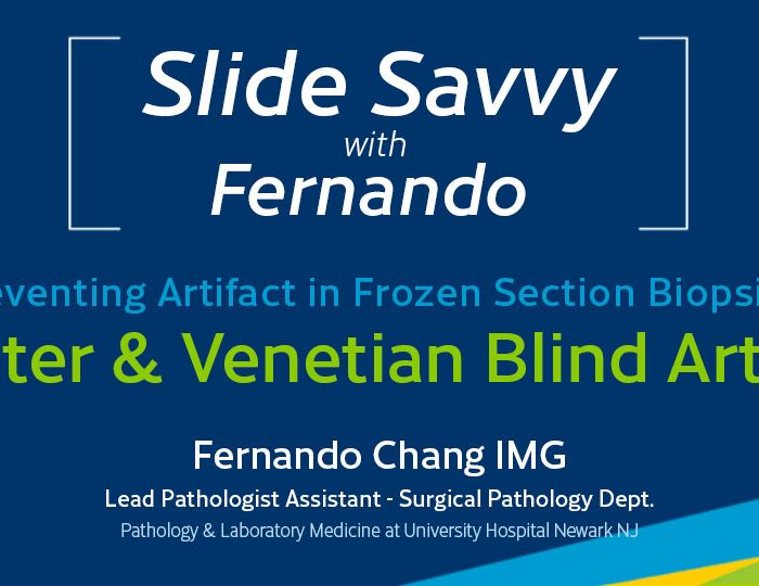 Slide-Savvy-series-shatter-venetian-blind