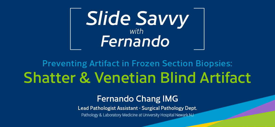 Slide-Savvy-series-shatter-venetian-blind