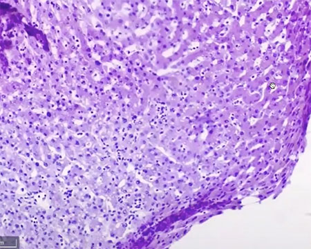 overstain-section